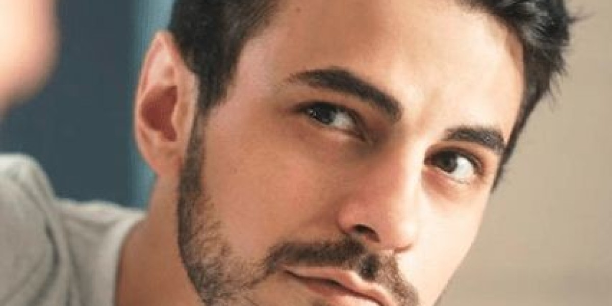 Can Women Benefit from Hair Transplant in Riyadh? Here’s What to Know