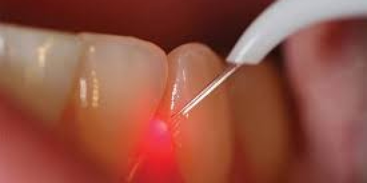 Dental Lasers Market Dynamics: Exploring Demand Shifts, Innovation, and Regional Expansion