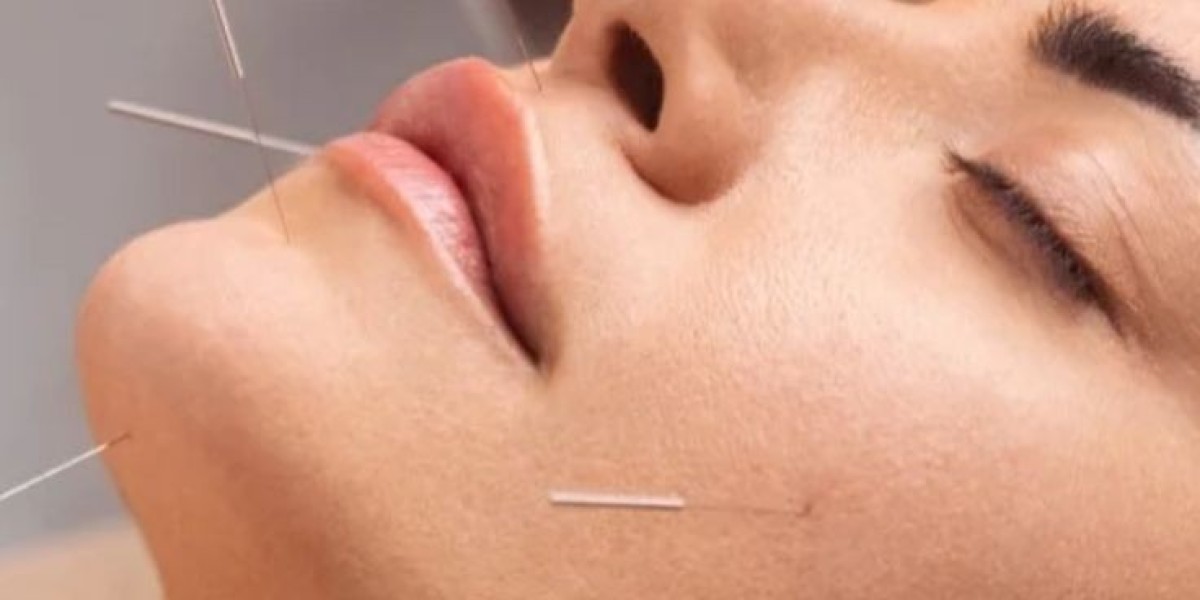 Discover Micro Needling with Acupuncture Benefits for Skin and Holistic Wellness
