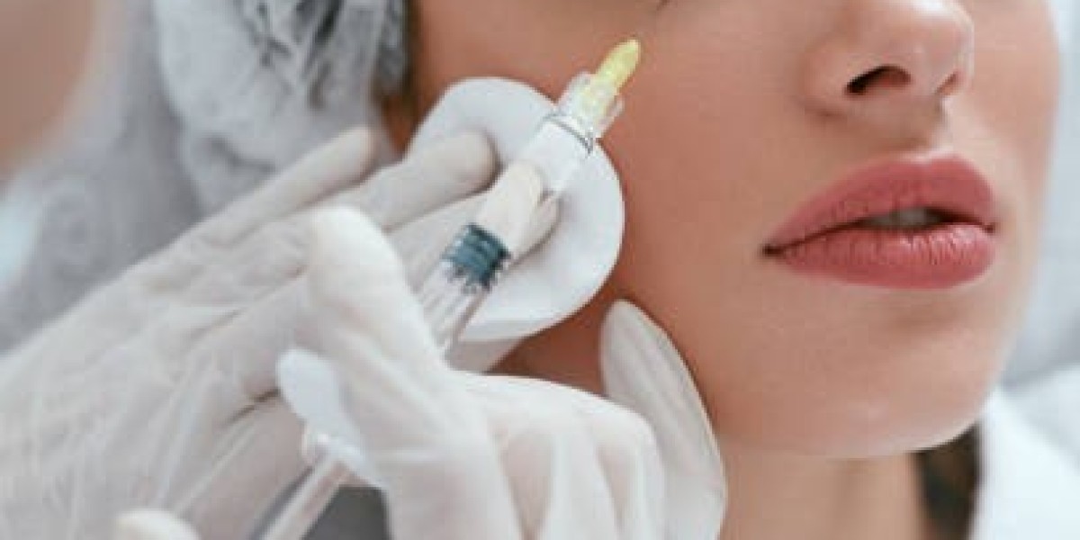 Is Your Skin Ready for Chemical Peels in Riyadh?