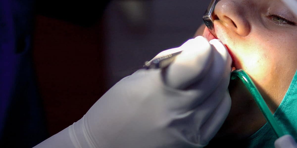 Root Canal Reviews in Islamabad: What Patients Say