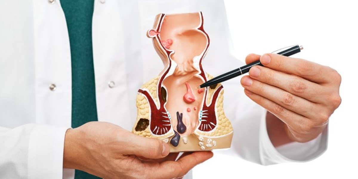 Best Options for Fissure Treatment in Delhi – Quick & Confidential