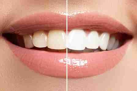 Image Source - Emergency Dentist Nottingham