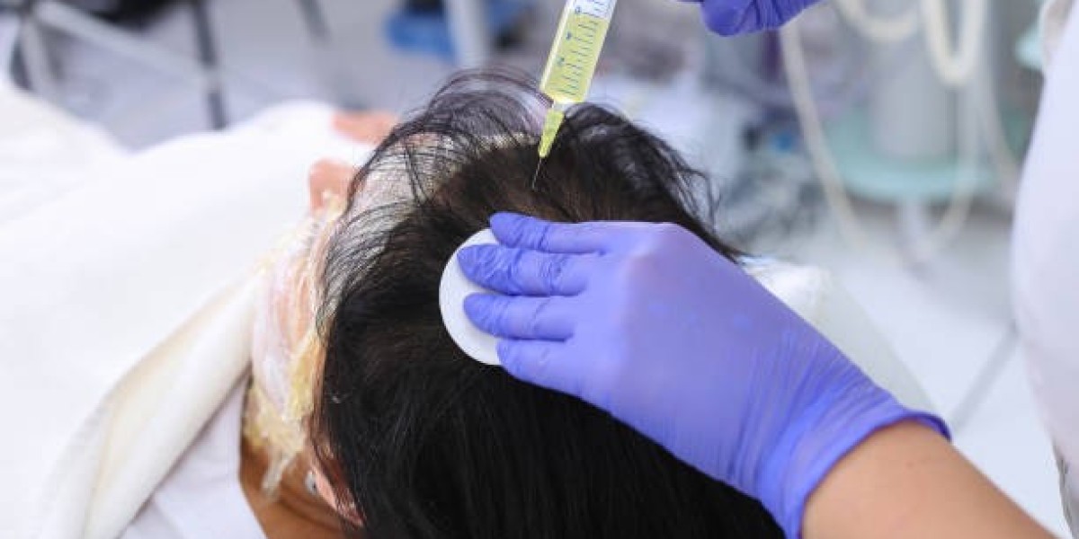 Common Myths About PRP Hair Treatment in Riyadh