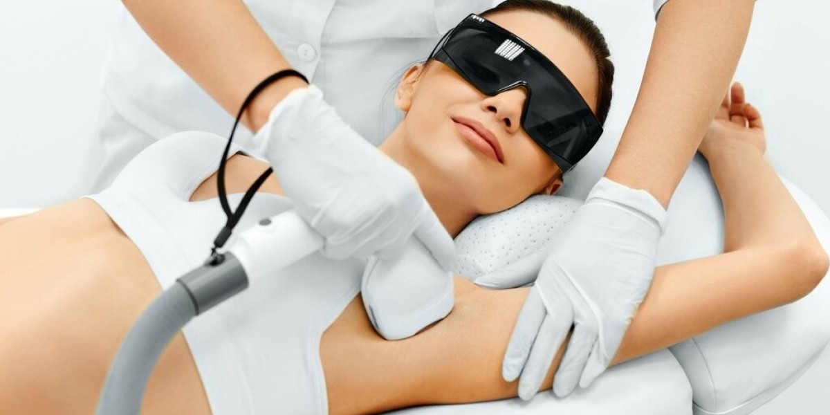 Can laser hair removal treat facial hair in women?