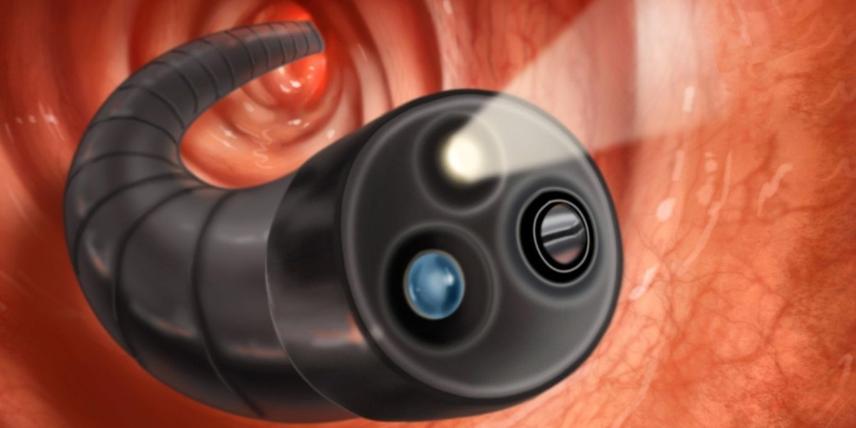 Colonoscopy Devices Market Opportunities Fueled by Rising Colorectal Screenings