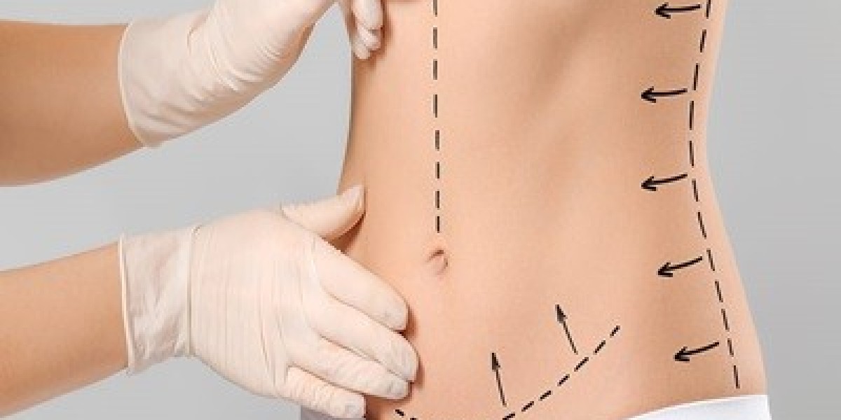 Why Patients Are Choosing Mini Abdominoplasty in Dubai Over Traditional Options
