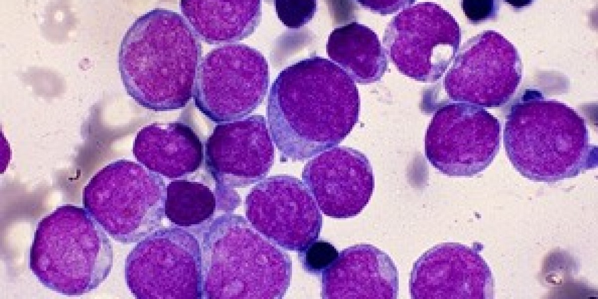 Acute Myeloid Leukemia (AML) Market Size, Trends, and Growth Forecast 2025-2032