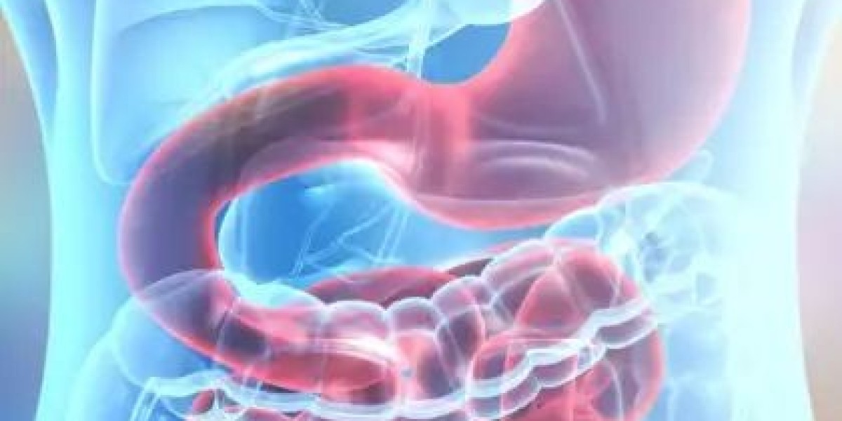 How to Prepare for Obesity Surgery Riyadh?