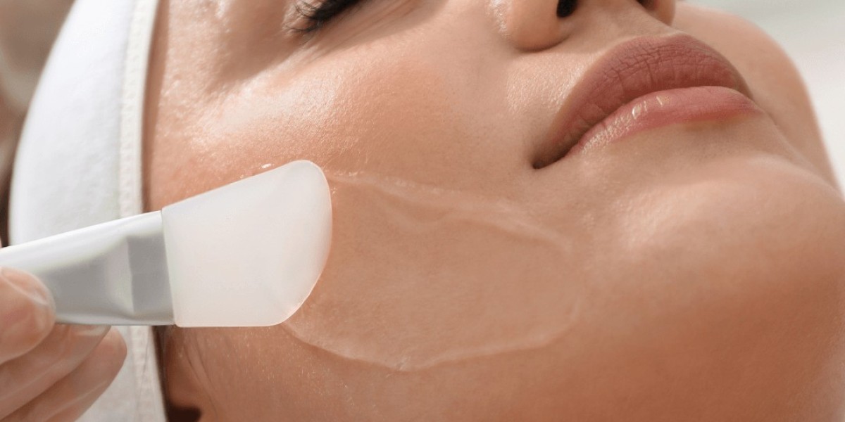 What Is a Glycolic Acid Peel and How Does It Work?