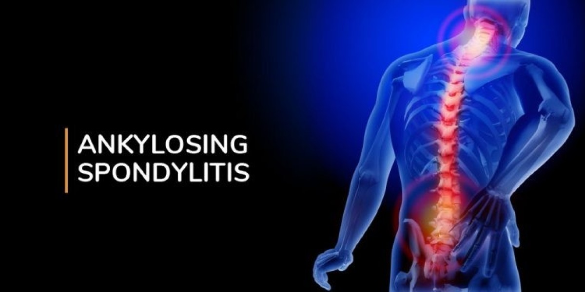 Ankylosing Spondylitis Market Size, Trends, and Growth Analysis 2025-2032