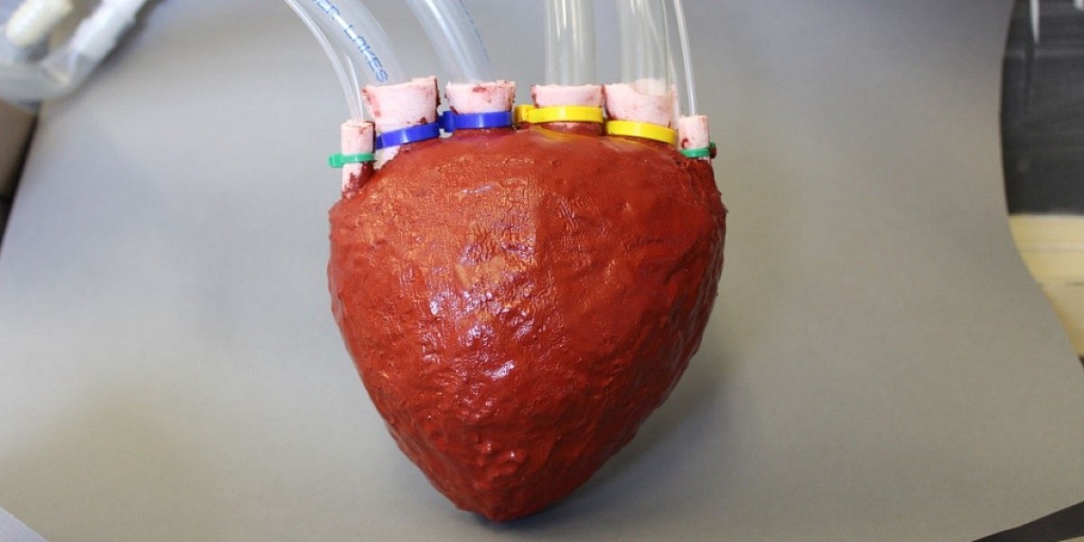 Emerging Opportunities in the Artificial Organ Market for Ambulatory Care Centers