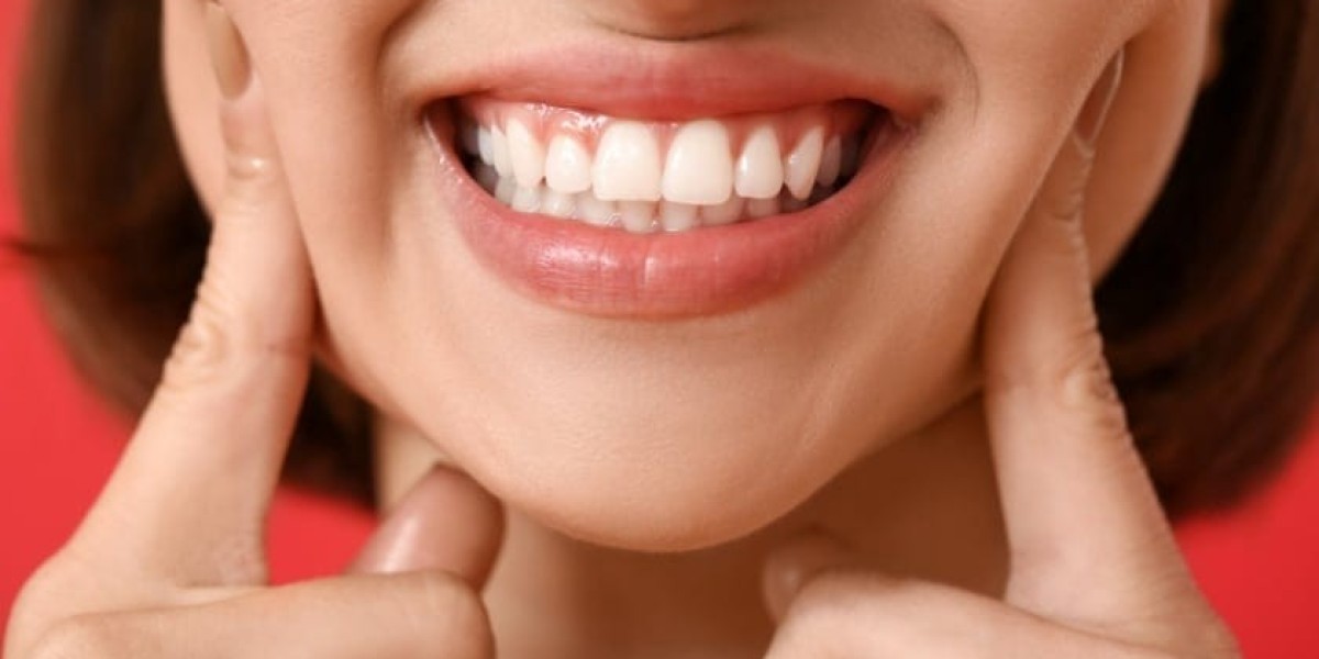 Can Teeth Whitening Fix Discoloration from Aging?