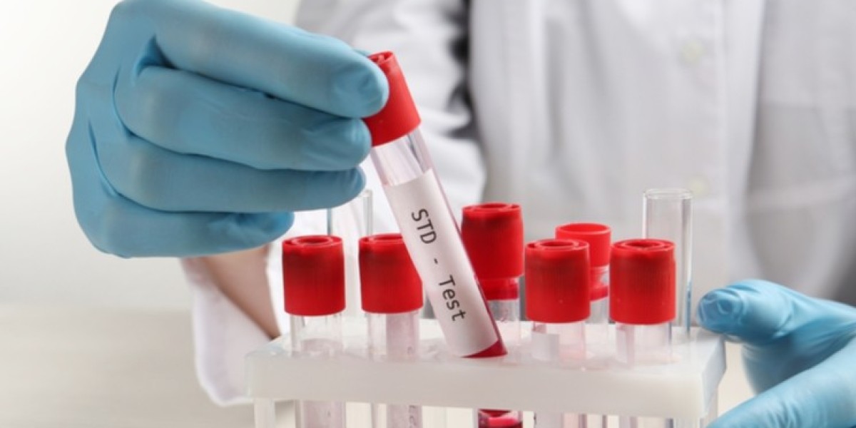 STD Test in Dubai for Women: Special Concerns and FAQs