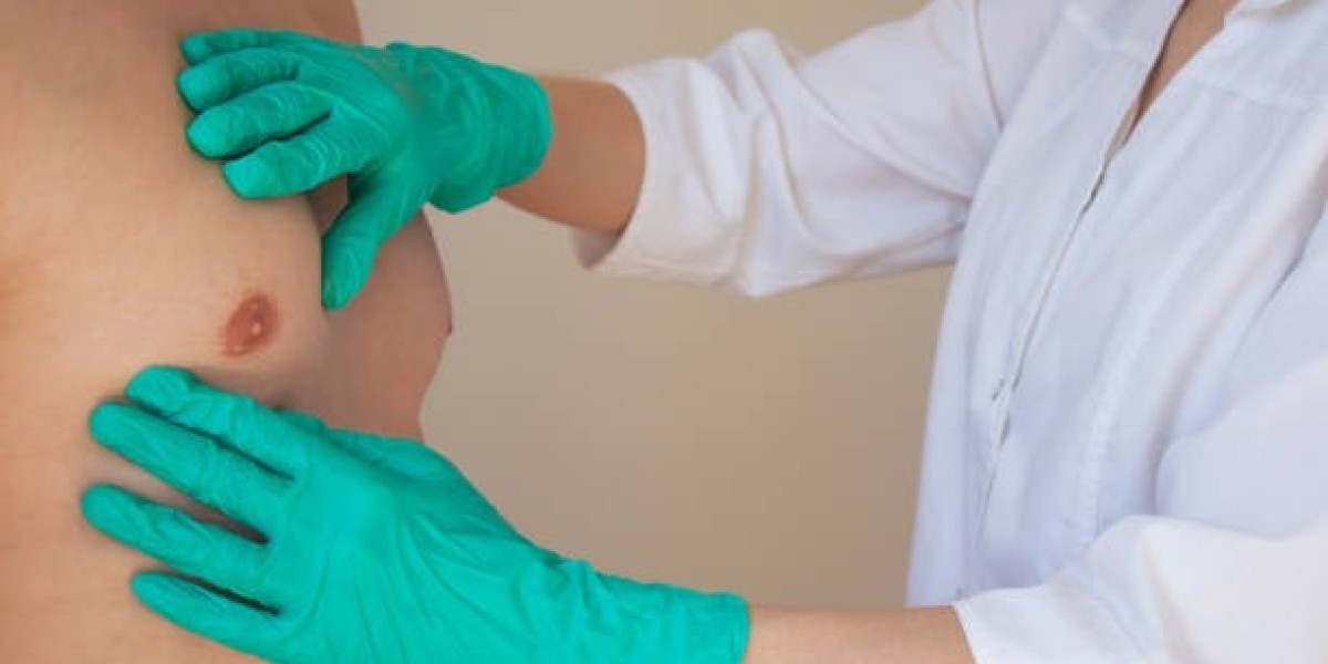 Gynaecomastia in Dubai: Causes and Cures