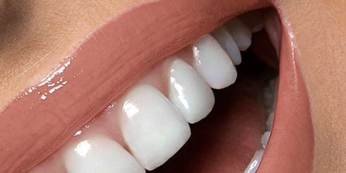 Dentist for Periodontal Care in Riyadh: Protecting the Foundation of Your Smile