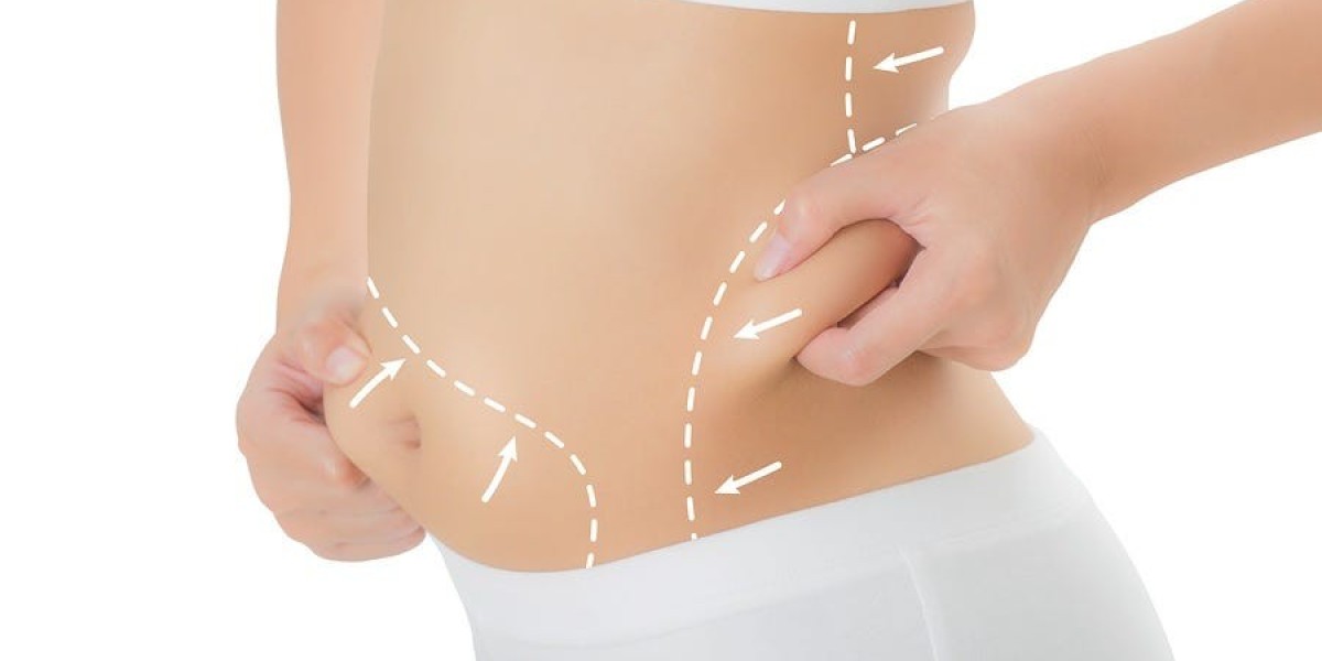 Is Tummy Tuck Surgery in Dubai Safe and Effective?