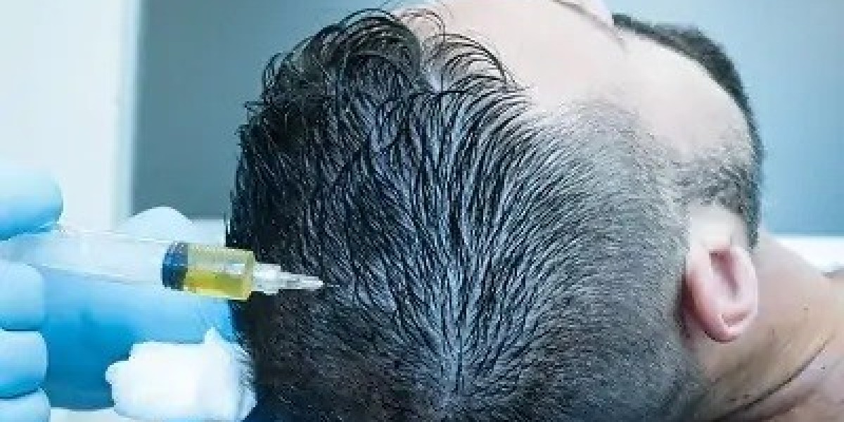 Why Celebrities Are Turning to GFC Hair Treatment in Dubai