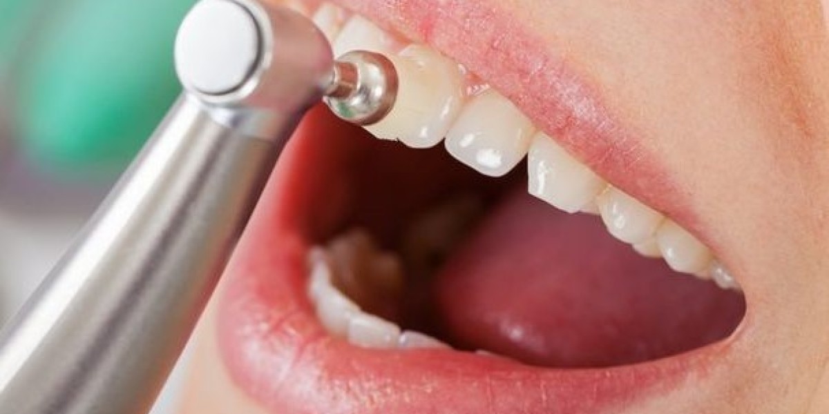Pain-Free Teeth Cleaning Clinics in Riyadh