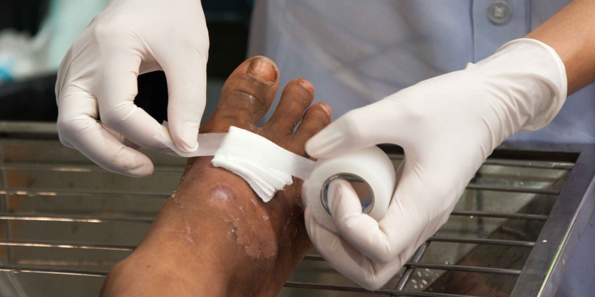 Is Wound Dressing at Home Painful?