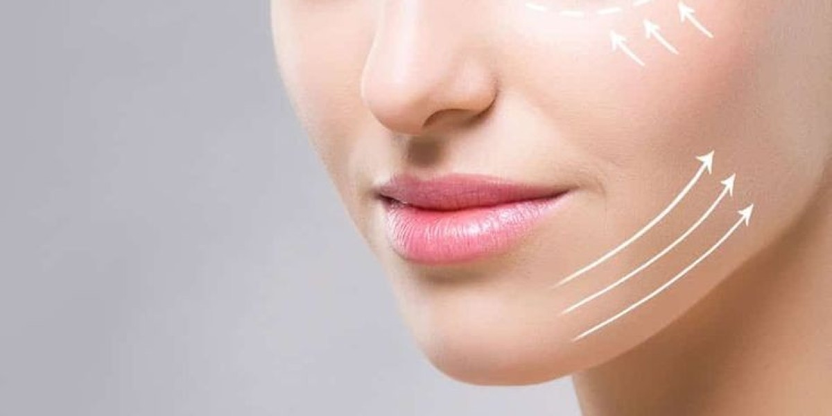 Long-Term Results from Facelift in Riyadh