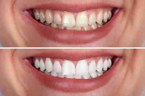 Image Source - Emergency Dentist Nottingham