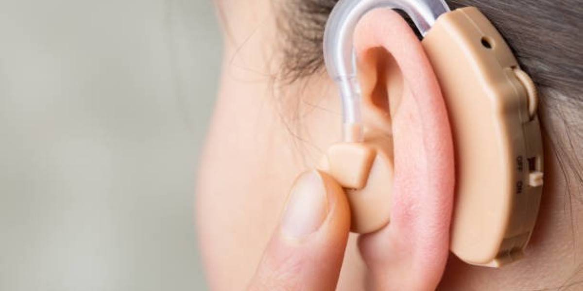 The Expanding France Hearing Aids Market: Trends and Growth Drivers