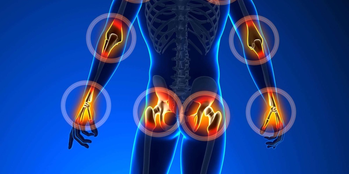 https://groups.google.com/g/arthrovit-australia/c/cjCpFugfCpE