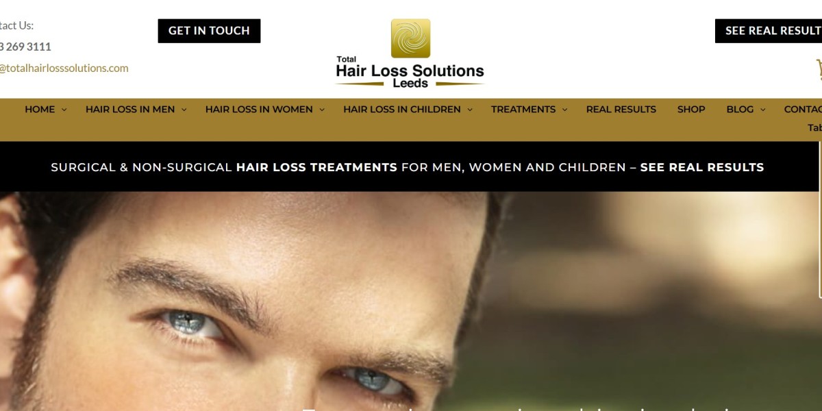 Best Hair Loss Consultations in Yorkshire: Expert Care for Lasting Results