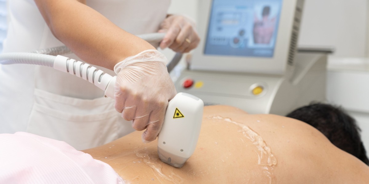 Laser Hair Removal in Dubai for Men: Breaking the Stigma and Embracing Smooth Skin