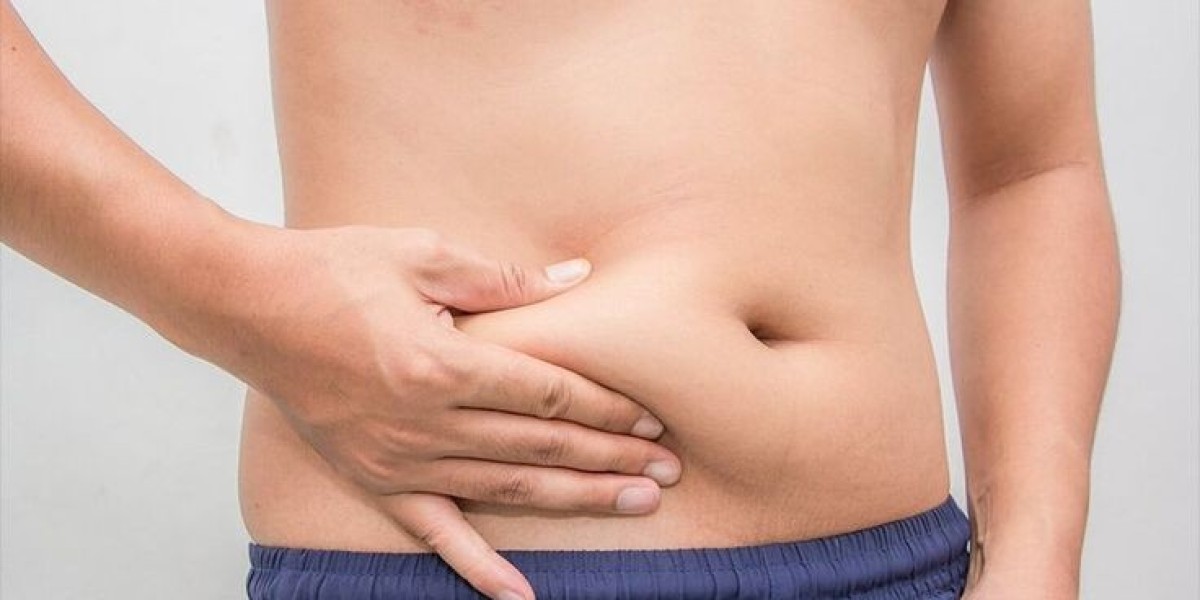 How Liposuction in Riyadh Improves Confidence and Body Shape