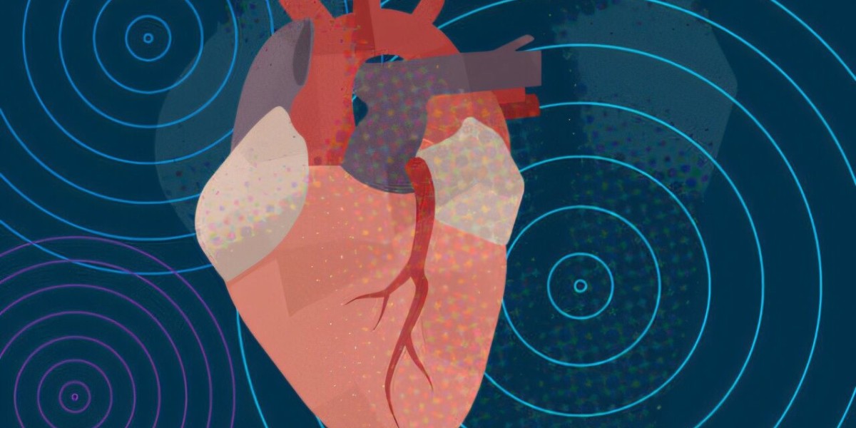 Atrial Fibrillation (Afib) Market Analysis Reveals Rising Demand for Advanced Cardiac Care Devices