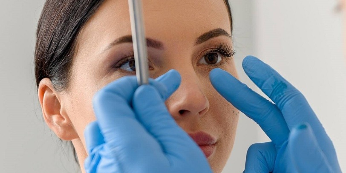 Achieve the Perfect Nose with Expert Rhinoplasty