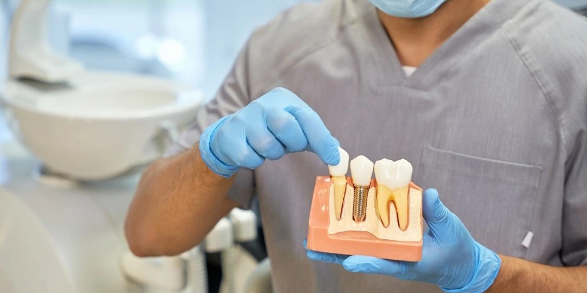 Make over Any Happy by means of Dental Implants in Darwin