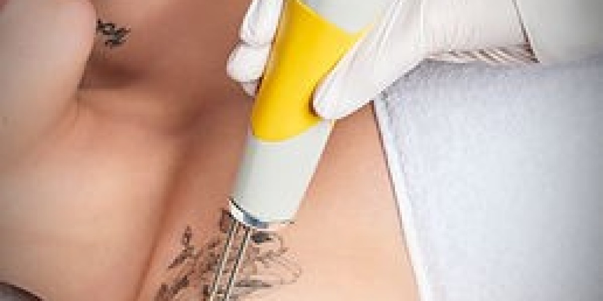 Laser Hair Removal in Sartell