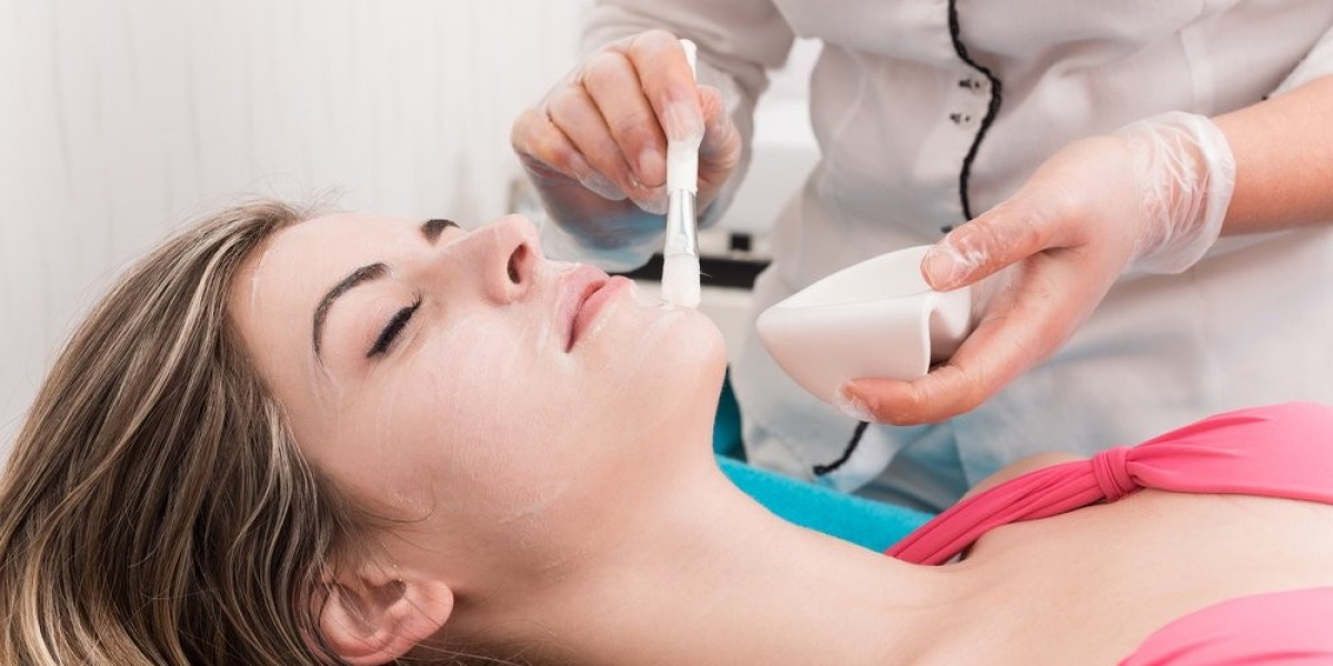 Chemical Peels in Islamabad: Myths vs. Facts