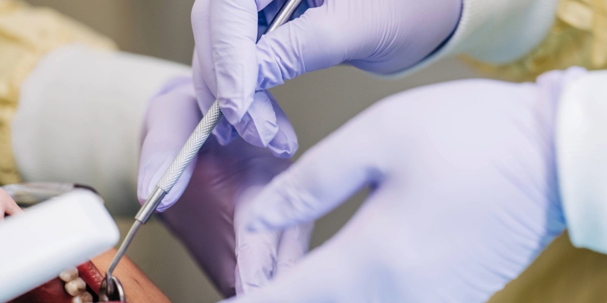 How General Dentistry Keeps Gum Disease at Bay