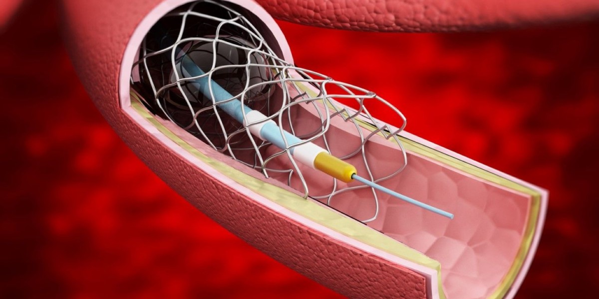 How Reimbursement Policies Are Impacting the Coronary Stents Market