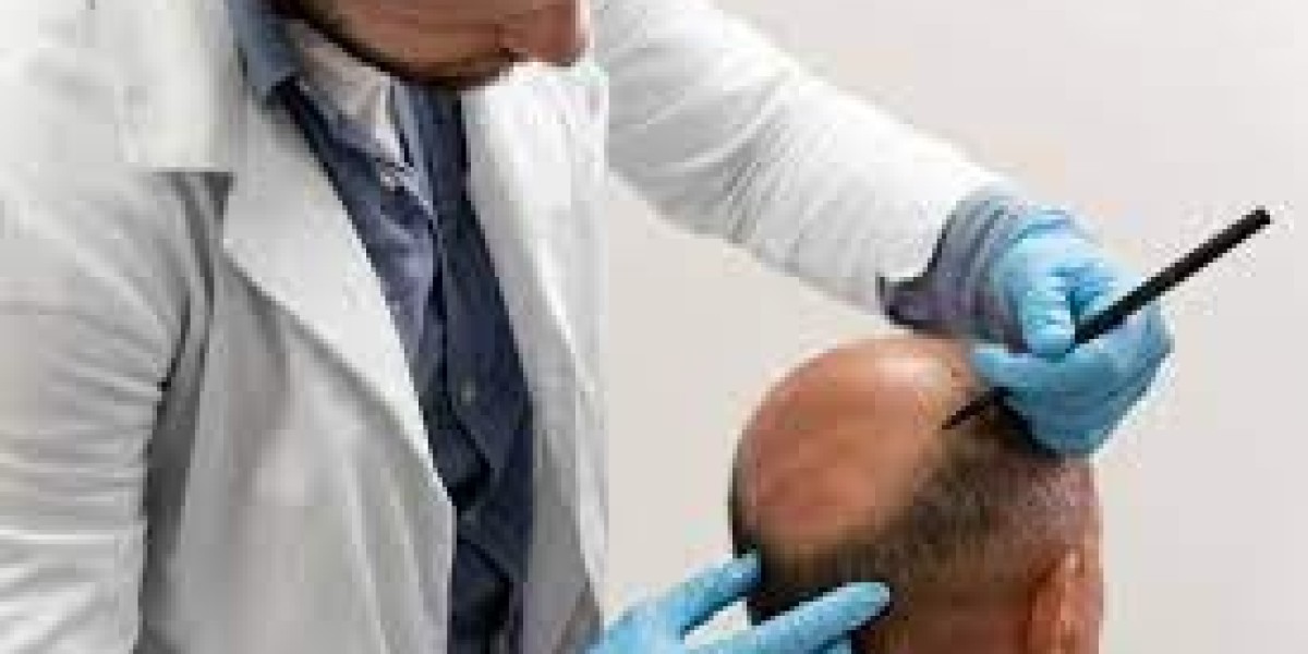Compare Hair Transplant Costs in Dubai – Glamorous Clinic Leads