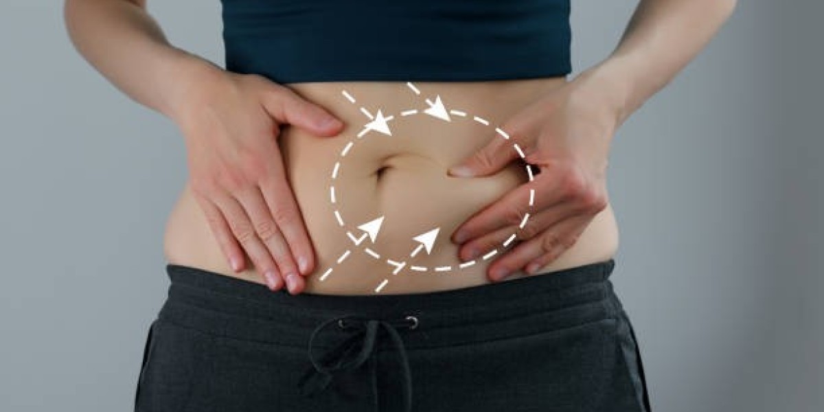 Tummy Tuck for Post-Pregnancy Body Contouring