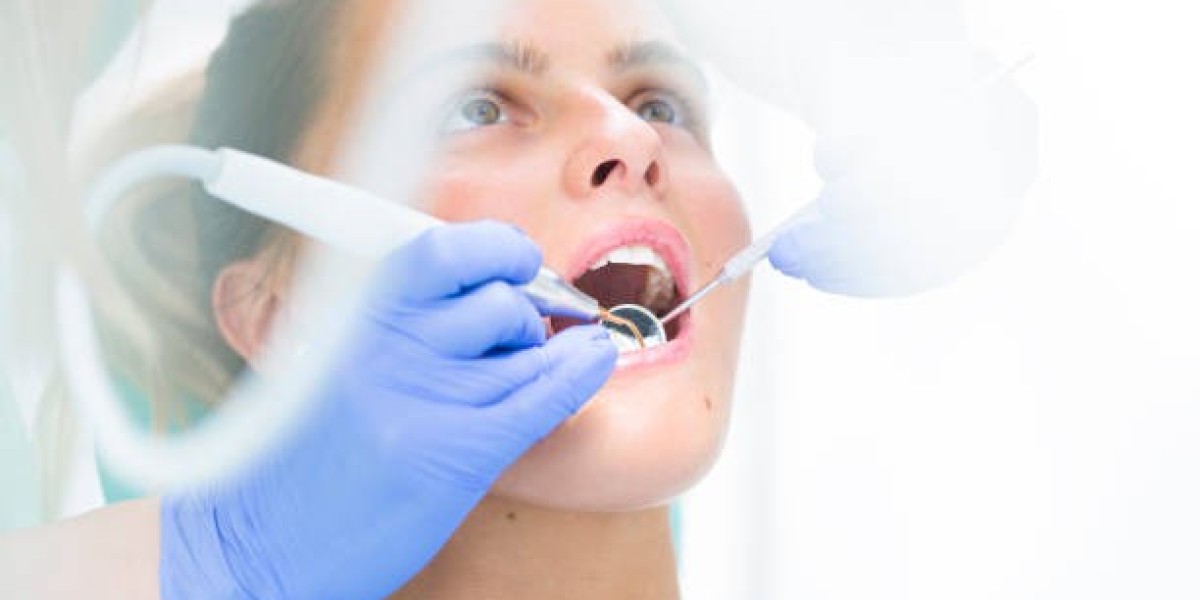 The Link Between Cavities and Dental Fillings: Prevention Tips