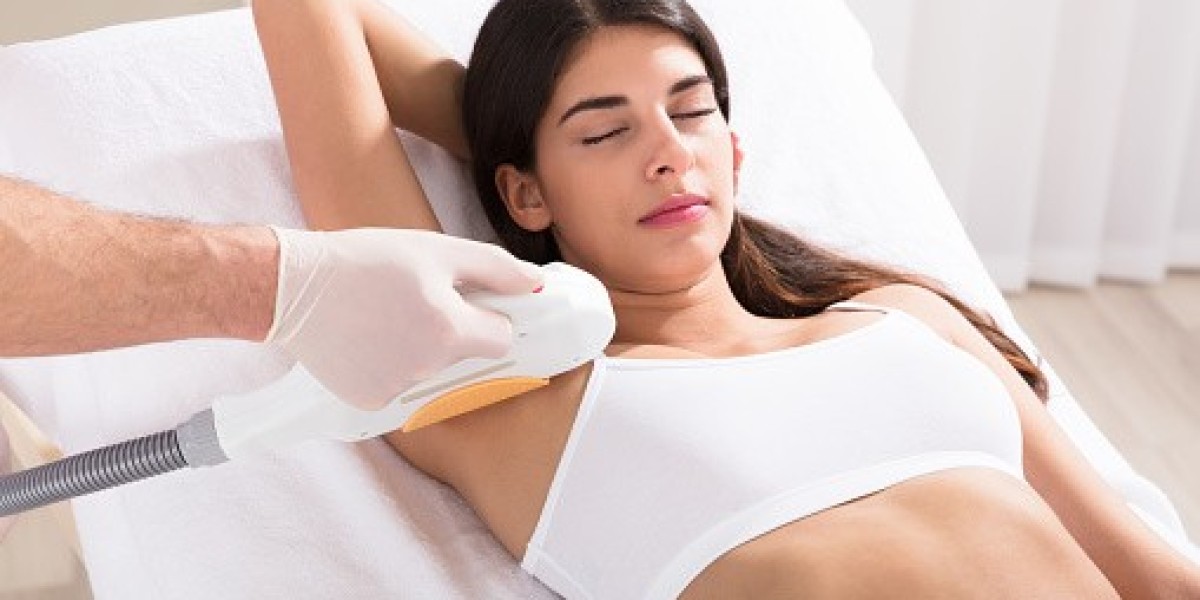 Top Questions About Laser Hair Removal in Dubai Answered by Experts