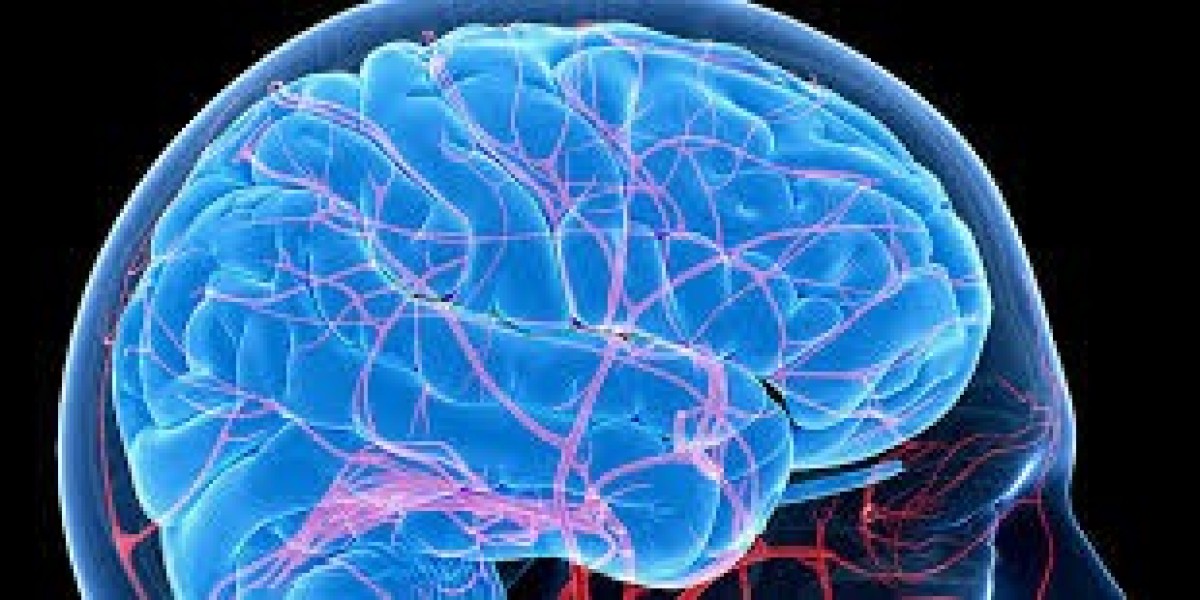 Neurovascular Devices Market: Advancements, Trends, and Future Growth Prospects