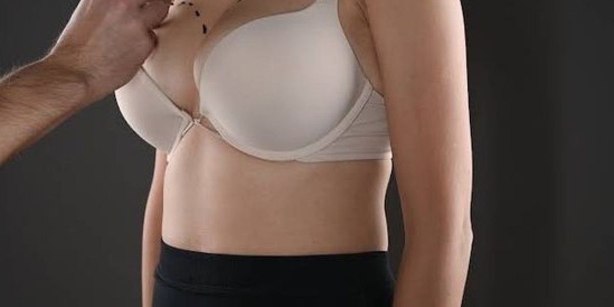Riyadh’s Breast Surgery: From Consultation to Care