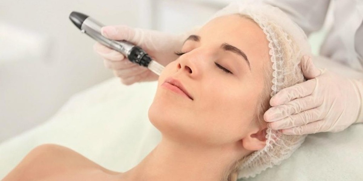 Does Microneedling Help Fade Dark Spots?