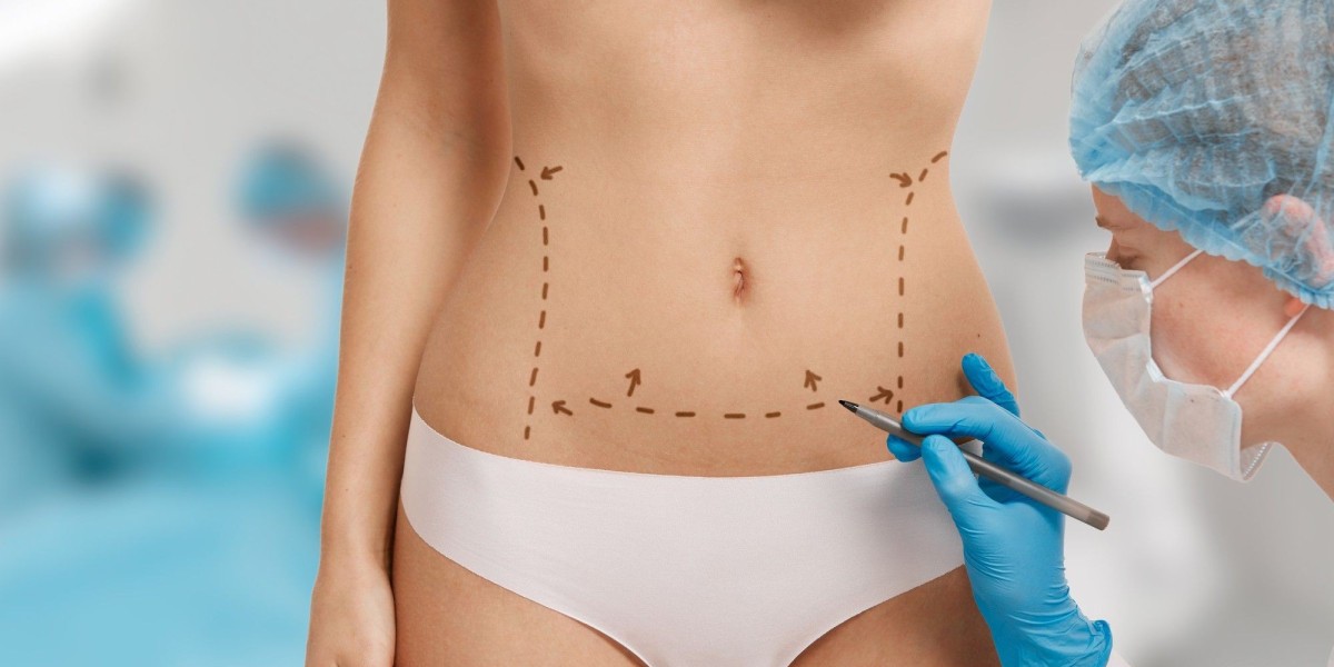 Riyadh’s Latest Techniques in Tummy Tuck Surgery