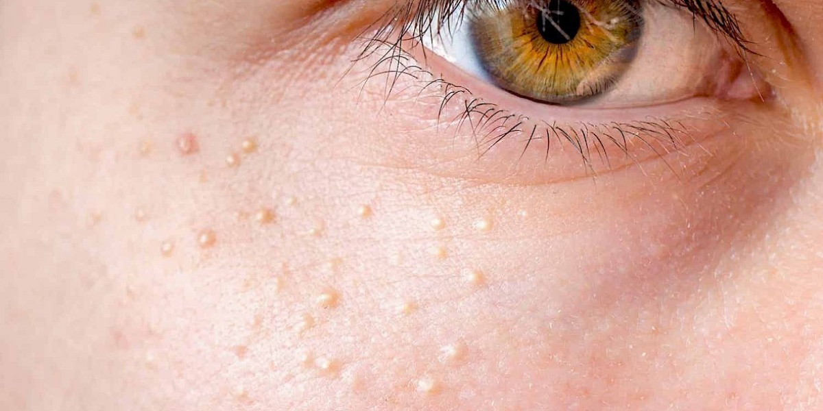 Restore Confidence with Emsella in Plano, Texas