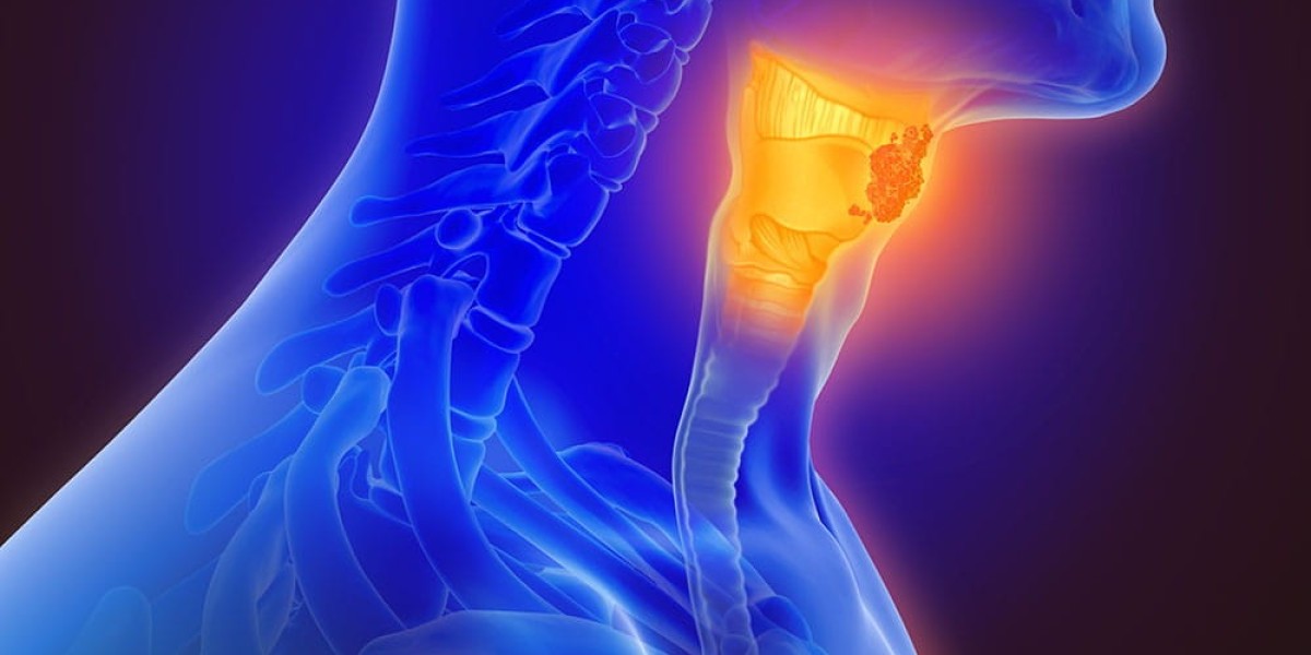 Oropharyngeal Cancer Market Size, Trends, and Growth Outlook 2025-2032