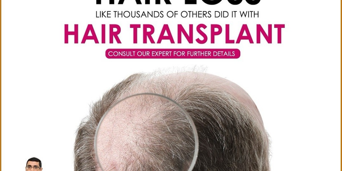 Best Hair Transplant in Ludhiana: Restore Confidence with Natural Results