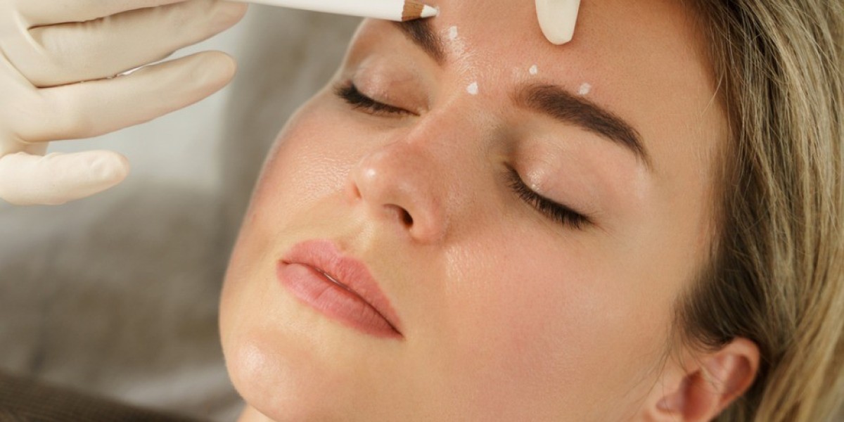 Is It Safe to Use Fillers During Menopause?
